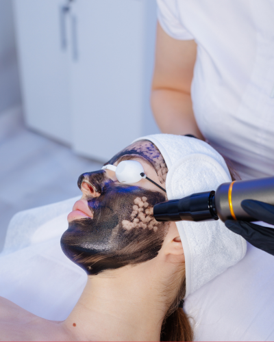 Laser Treatments Laser Treatments